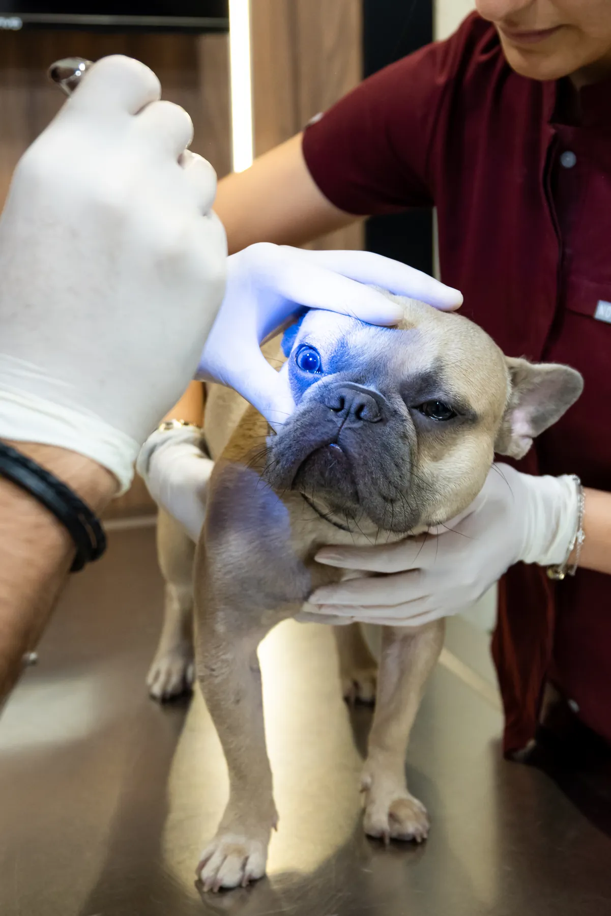 Göz Ünitesi